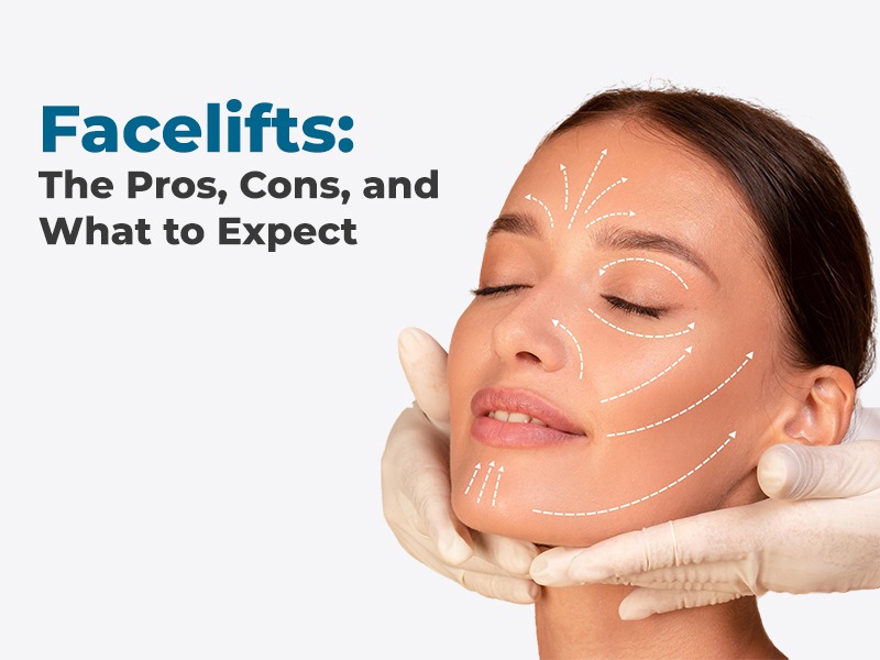 Facelifts: The Pros, Cons, and What to Expect