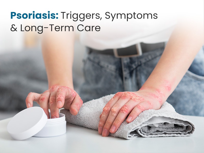 Psoriasis: Triggers, Symptoms & Long-Term Care