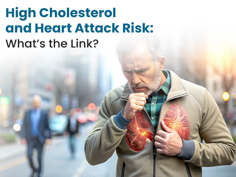 High Cholesterol and Heart Attack Risk: What’s the Link?