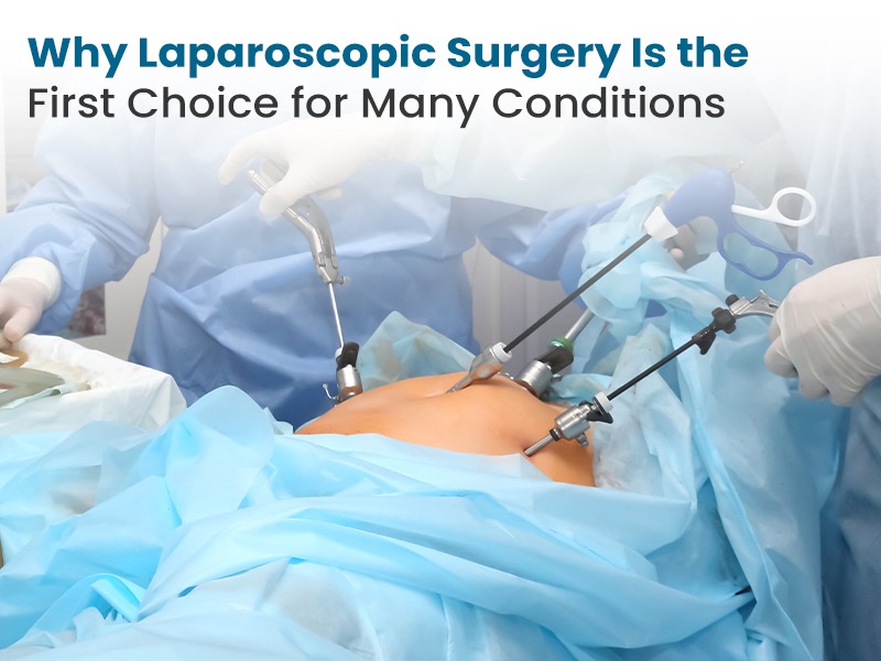 Why Laparoscopic Surgery Is the First Choice for Many Conditions