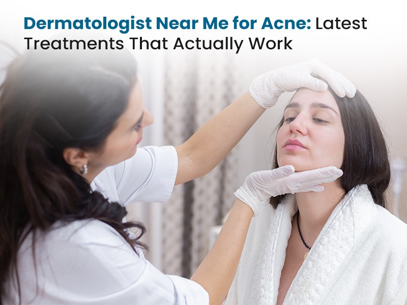 Dermatologist Near Me for Acne Latest Treatments That Actually Work