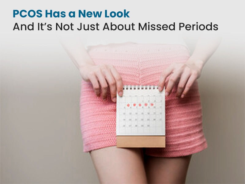 PCOS Has a New Look — And It’s Not Just About Missed Periods
