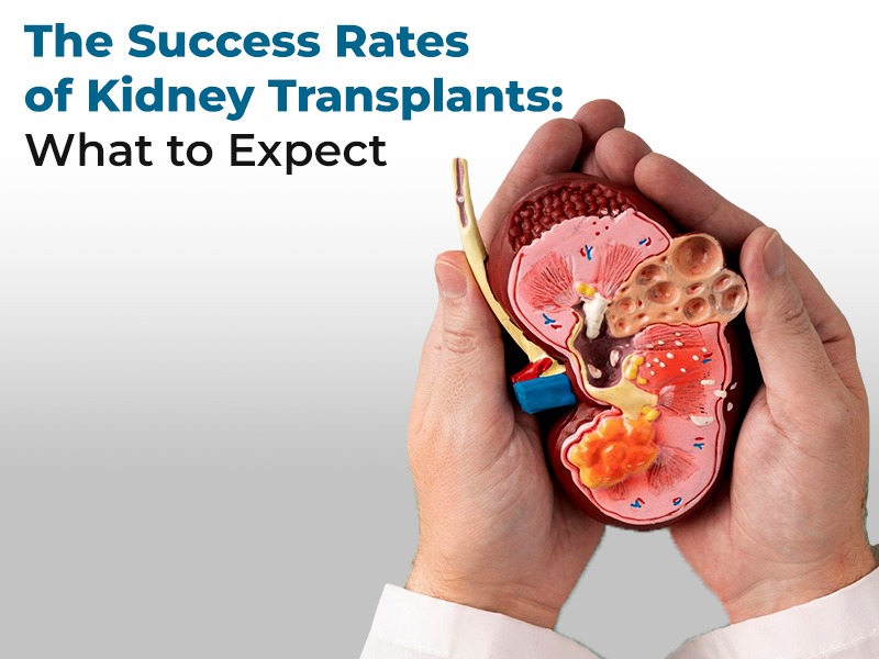 The Success Rates of Kidney Transplants: What to Expect