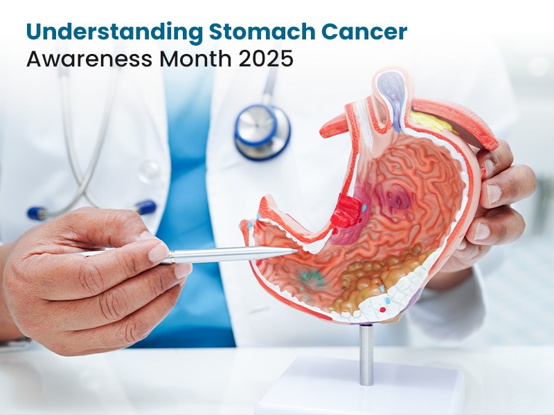 Understanding Stomach Cancer Awareness Month 2025