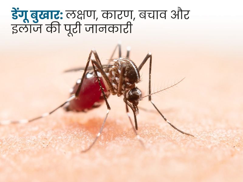 डेंगू बुखार: लक्षण, कारण, बचाव और इलाज की पूरी जानकारी