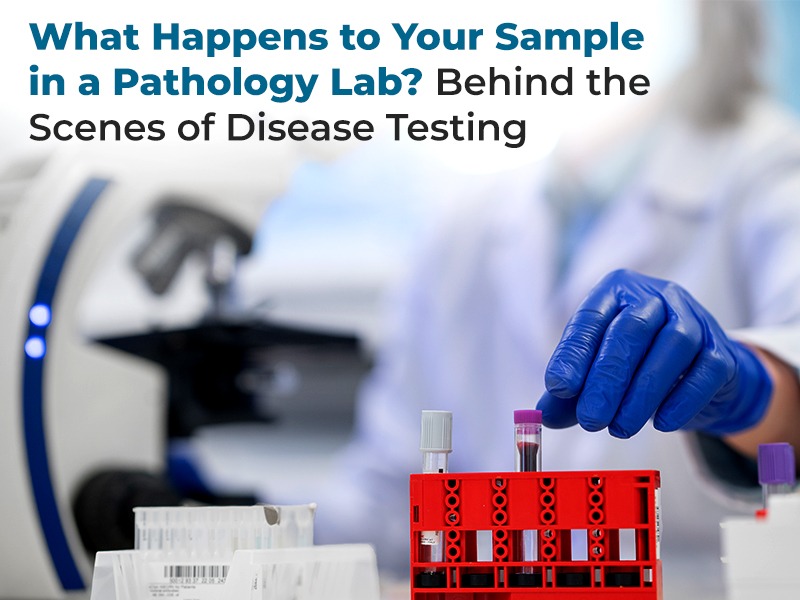 What Happens to Your Sample in a Pathology Lab? Behind the Scenes of Disease Testing