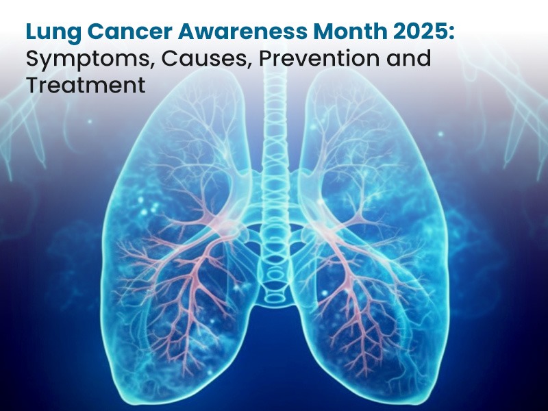 Lung Cancer Awareness Month 2025: Symptoms, Causes, Prevention and Treatment