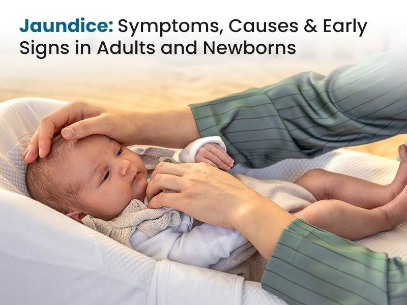 Jaundice: Symptoms, Causes & Early Signs in Adults and Newborns