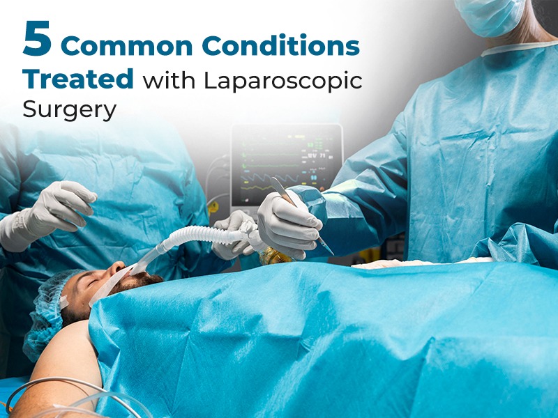 5 Common Conditions Treated with Laparoscopic Surgery