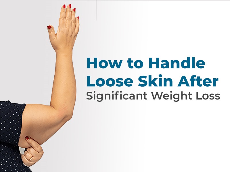 How to Handle Loose Skin After Significant Weight Loss