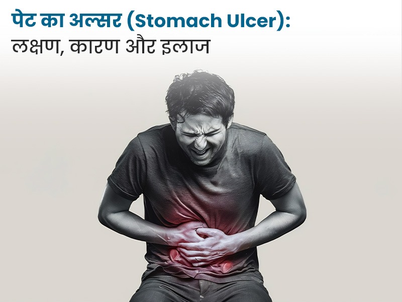 पेट का अल्सर (Stomach Ulcer): लक्षण, कारण और इलाज