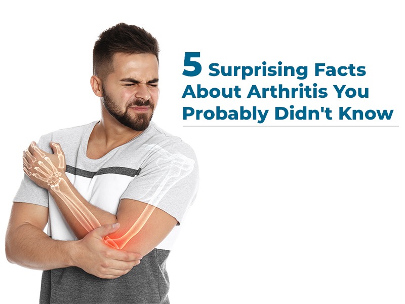 5 Surprising Facts About Arthritis You Probably Didn't Know