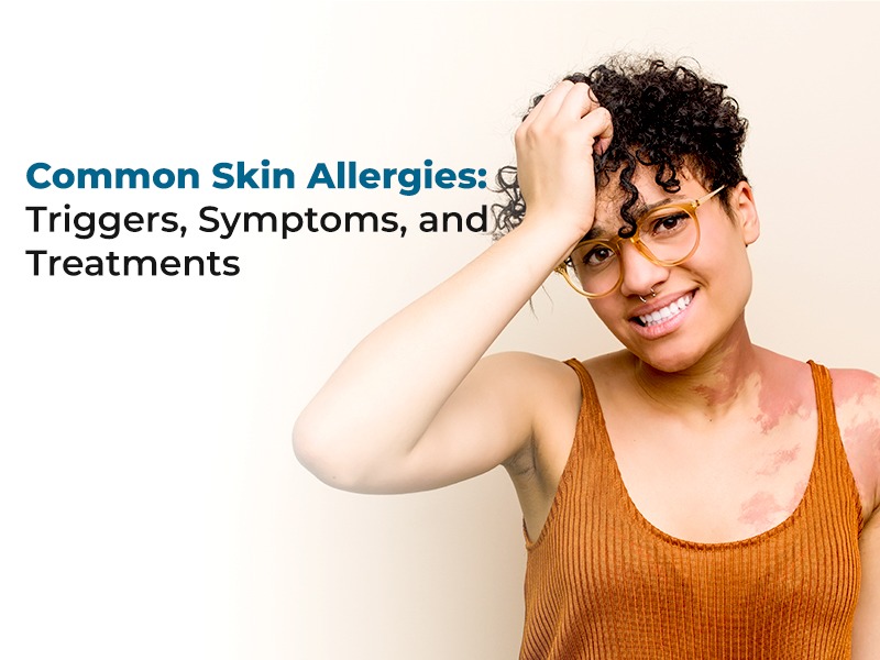 Common Skin Allergies: Triggers, Symptoms, and Treatments