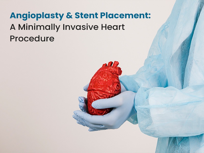 Angioplasty & Stent Placement: A Minimally Invasive Heart Procedure