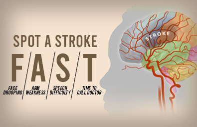 Brain Stroke Clinic