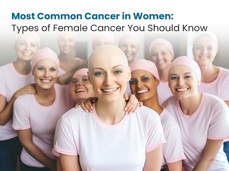 Most Common Cancer in Women: Types of Female Cancer You Should Know
