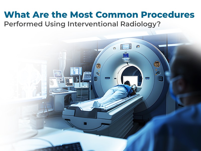 What Are the Most Common Procedures Performed Using Interventional Radiology?