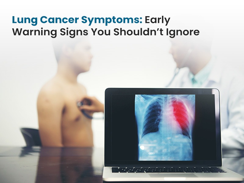 Lung Cancer Symptoms: Early Warning Signs You Shouldn’t Ignore