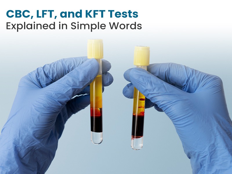 CBC, LFT, and KFT Tests Explained in Simple Words