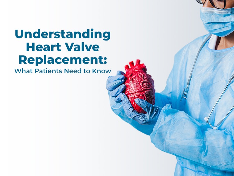 Understanding Heart Valve Replacement: What Patients Need to Know