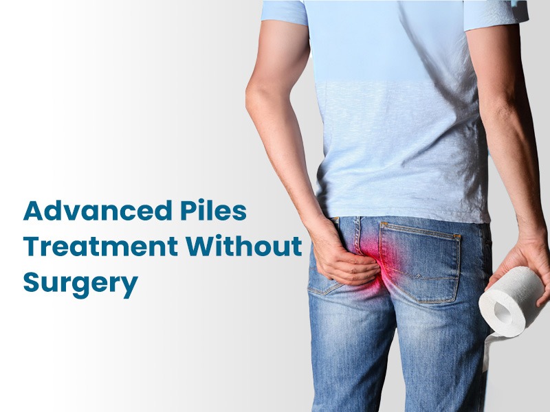 Advanced Piles Treatment Without Surgery: Effective Solutions for Lasting Relief
