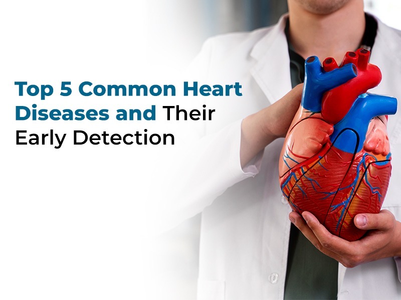 Top 5 Common Heart Diseases and Their Early Detection