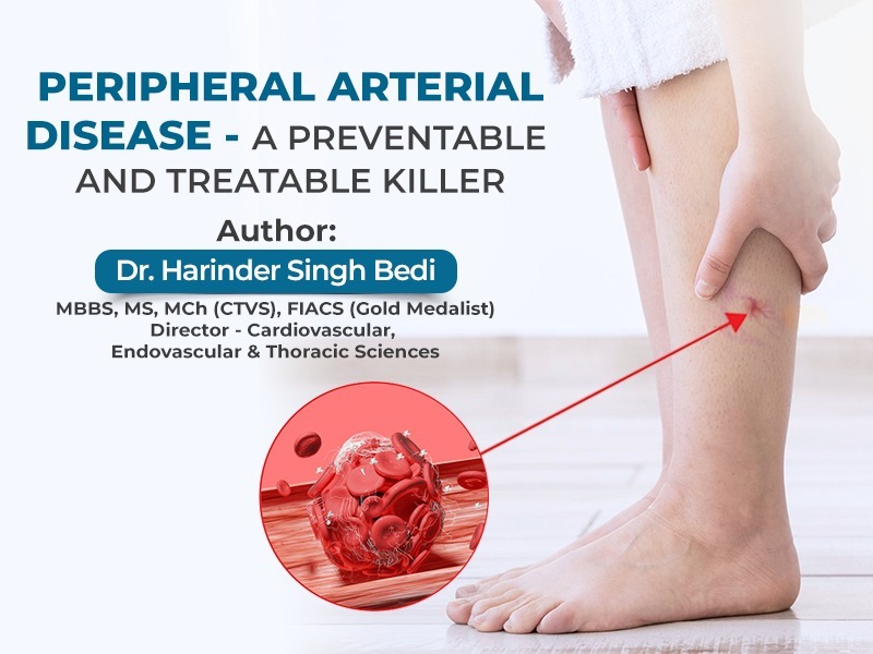 PERIPHERAL ARTERIAL DISEASE – A PREVENTABLE AND TREATABLE KILLER