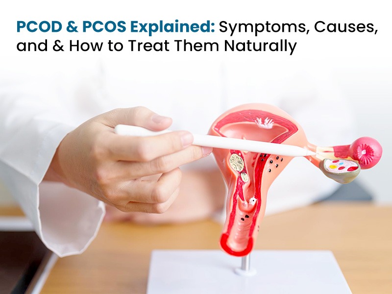 PCOD & PCOS Explained: Symptoms, Causes, and & How to Treat Them Naturally
