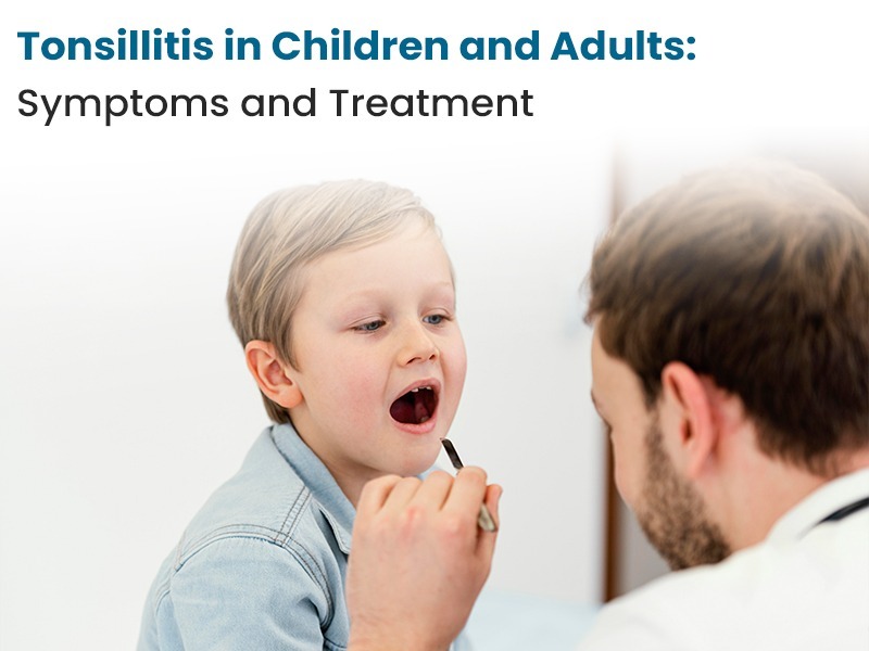 Tonsillitis in Children and Adults: Symptoms and Treatment