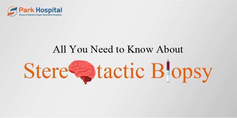 All You Need to Know About Stereotactic Biopsy