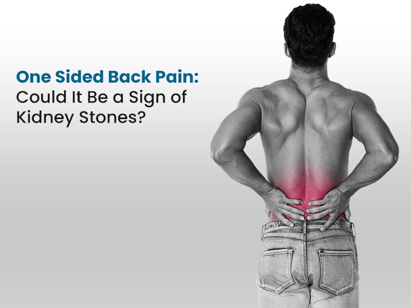 One Sided Back Pain: Could It Be a Sign of Kidney Stones?