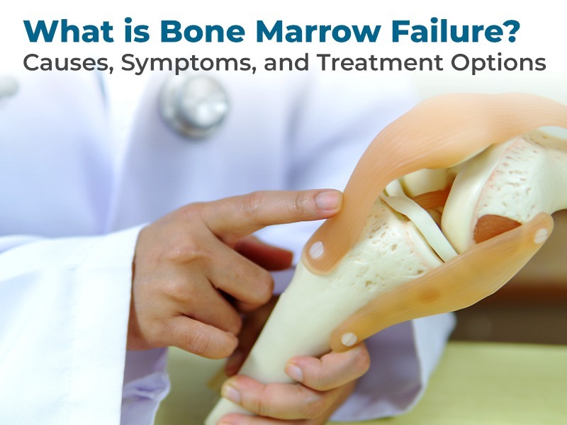 What is Bone Marrow Failure? Causes, Symptoms, and Treatment Options