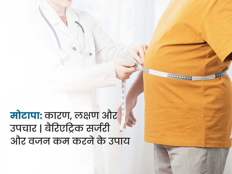 मोटापा: कारण, लक्षण और प्रभावी उपचार