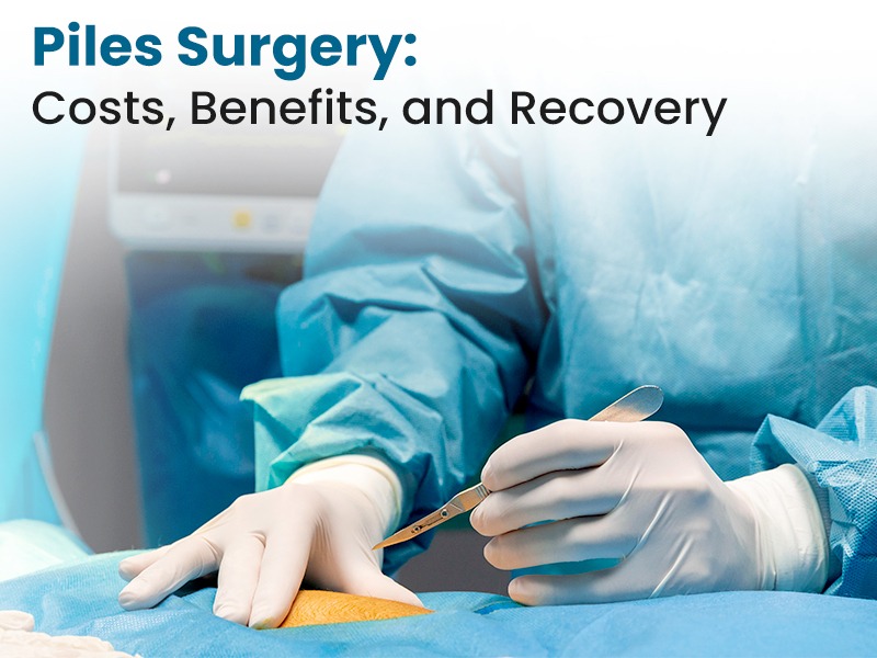 Piles Surgery: Costs, Benefits, and Recovery