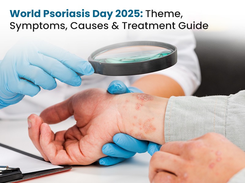 World Psoriasis Day 2025: Theme, Symptoms, Causes & Treatment Guide