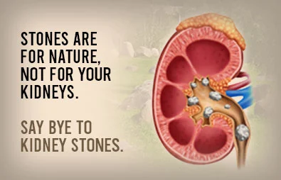 Kidney Stone Clinic