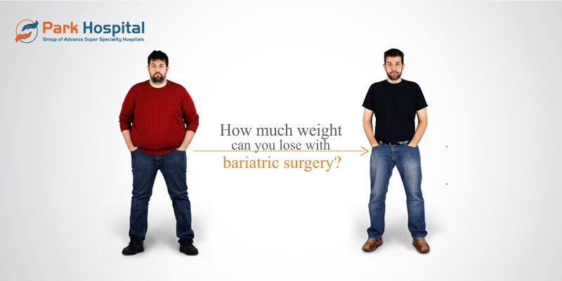 How much weight can you lose with bariatric surgery?