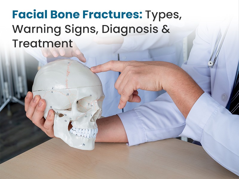 Facial Bone Fractures: Types, Warning Signs, Diagnosis & Treatment