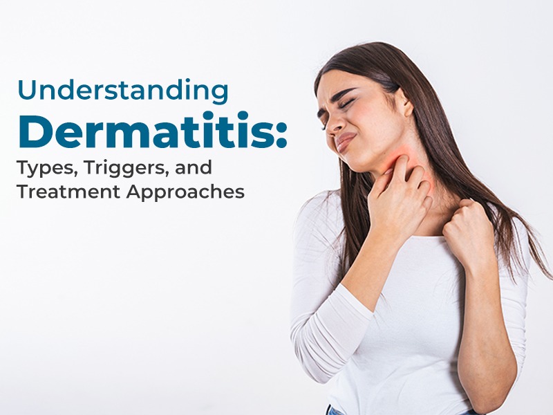 Understanding Dermatitis: Types, Triggers, and Treatment Approaches