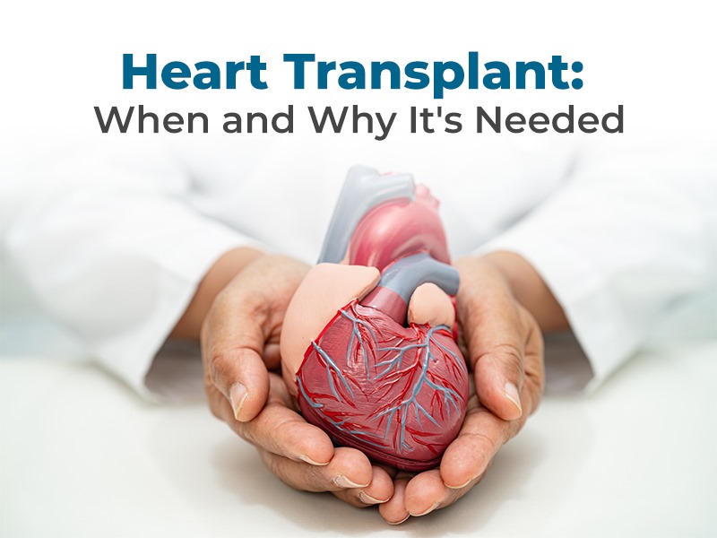 Heart Transplant: When and Why, It's Needed