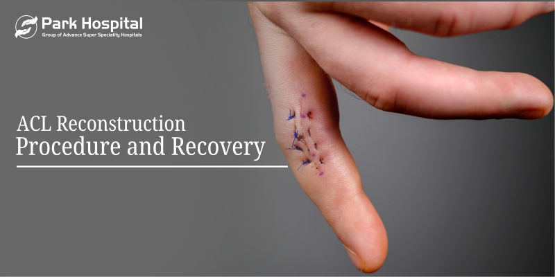 ACL reconstruction: Procedure and Recovery