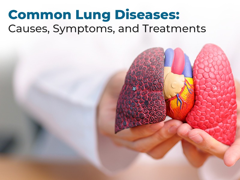 Common Lung Diseases: Causes, Symptoms, and Treatments