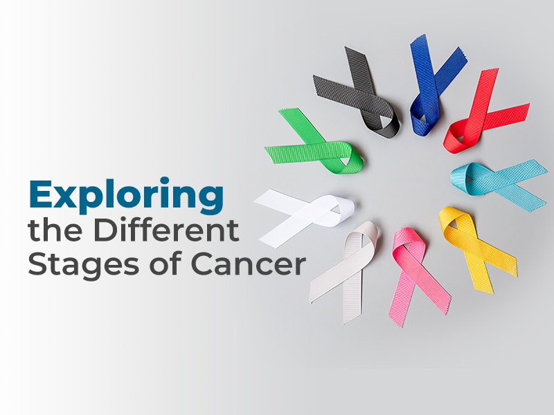 Exploring the Different Stages of Cancer