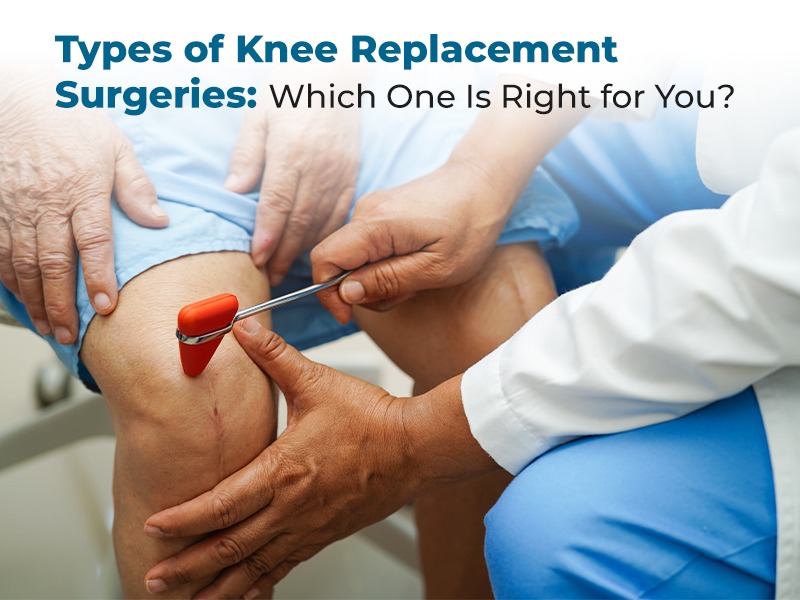 Types of Knee Replacement Surgeries: Which One Is Right for You?