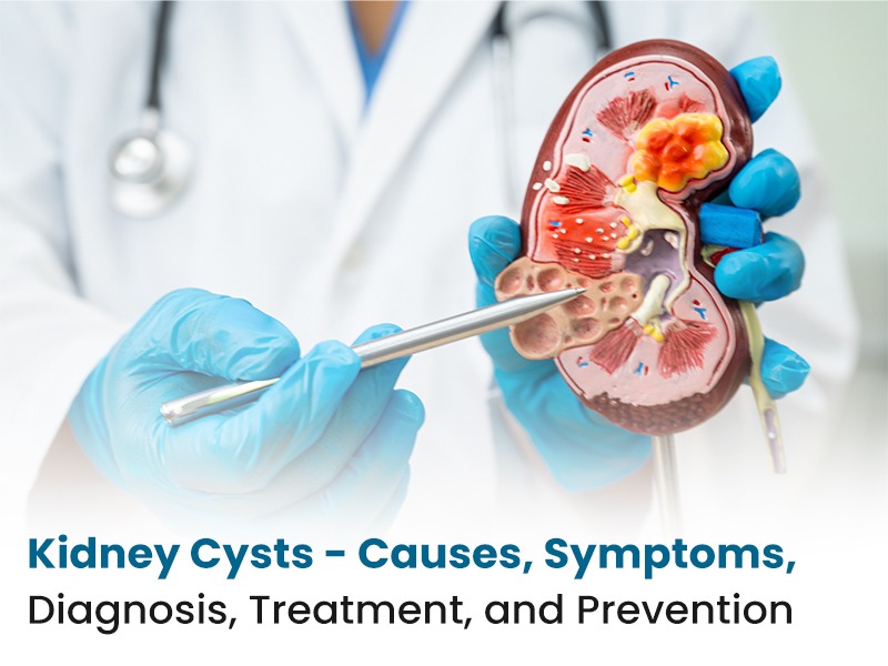 Kidney Cysts - Causes, Symptoms, Diagnosis, Treatment, and Prevention