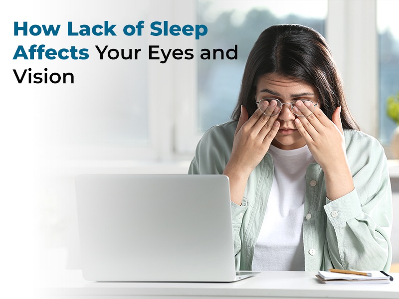 How Lack of Sleep Affects Your Eyes and Vision