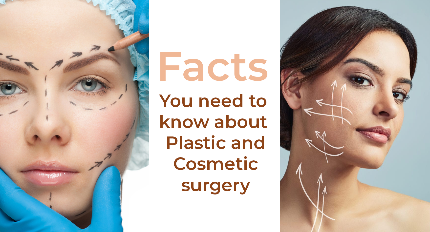 Facts you need to know about Plastic and Cosmetic surgery
