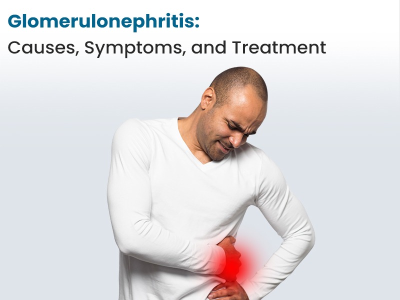 Glomerulonephritis: Causes, Symptoms, and Treatment