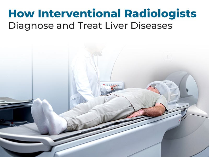 How Interventional Radiologists Diagnose and Treat Liver Diseases