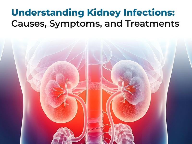 Understanding Kidney Infections: Causes, Symptoms, and Treatments